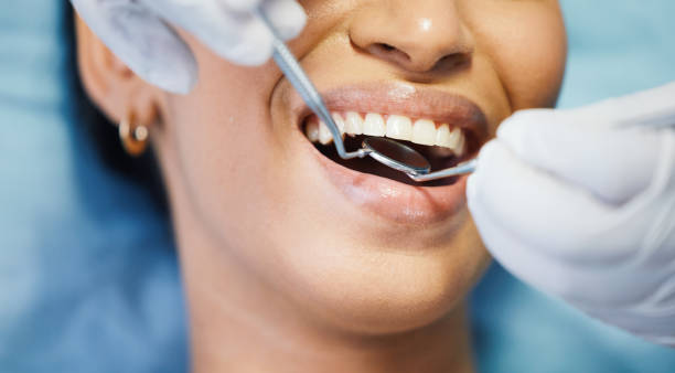 Best Emergency Broken Tooth Repair in Mansfield, LA